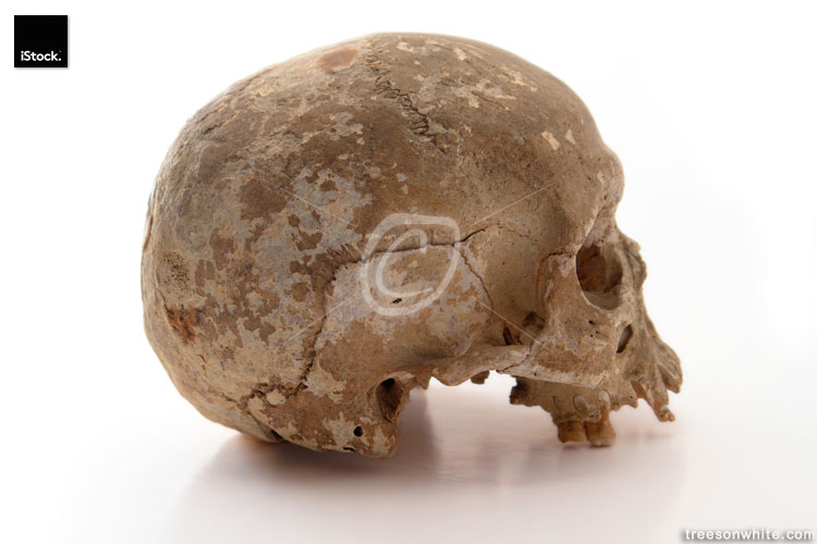 Image of human skull / side view