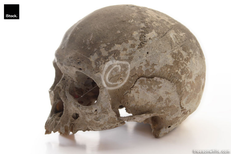Image of human Skull / side view